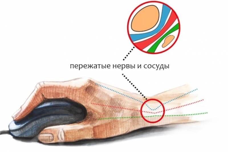 Зеркала сайта кракен tor